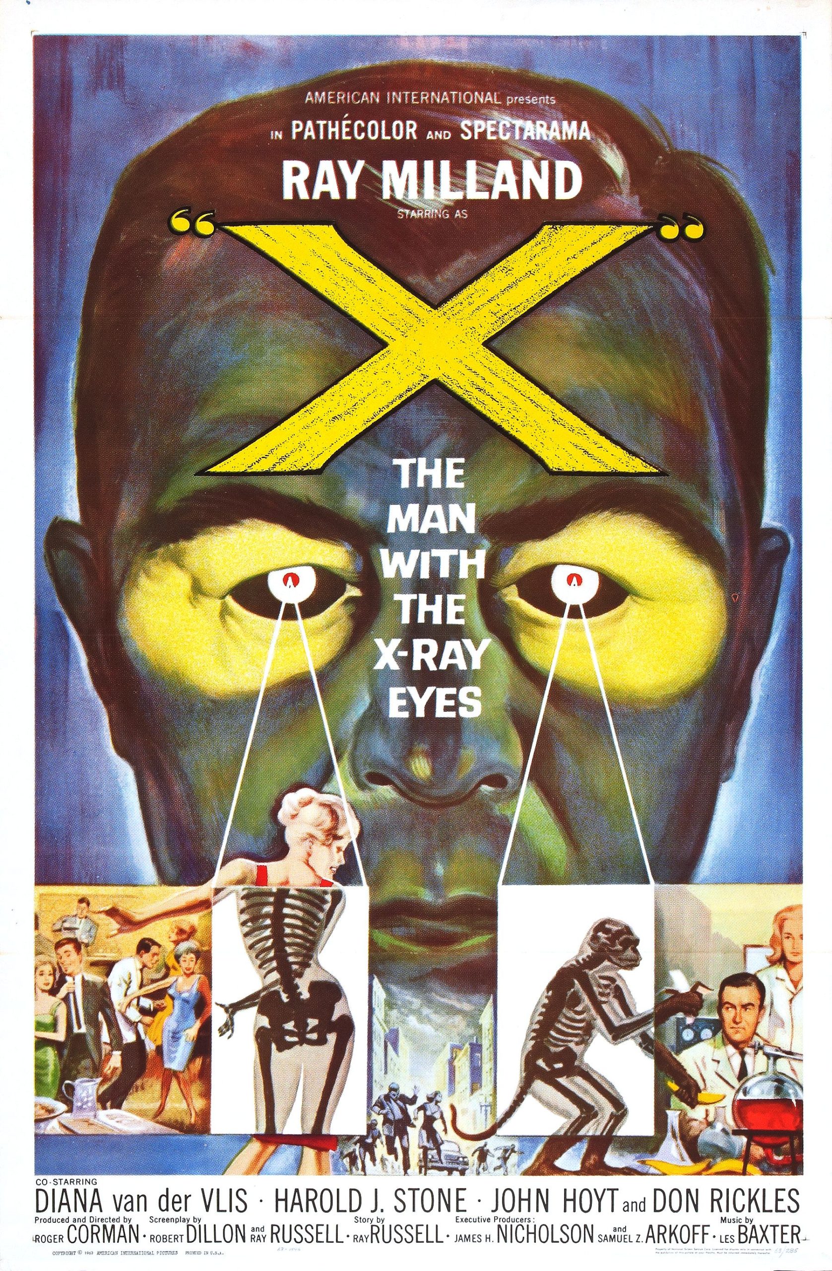 X: The Man with the X-Ray Eyes